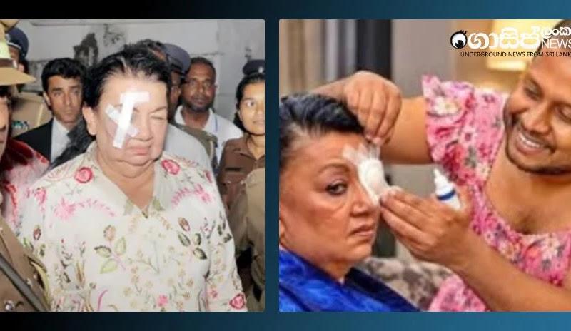 ශිරන්තිට ඇත්තටම ඇසේ ලෙඩක් තිබුණාද? ඇස් වාට්ටුවෙන් නැවත වැලිකඩ වාට්ටුවට